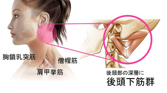 パニック障害の改善に必要な後頭下筋群